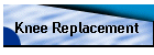 Knee Replacement